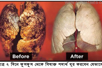 মাত্র ২ দিনে ফুসফুস থেকে বিষাক্ত পদার্থ দূর করবেন যেভাবে - Surma Times Archive