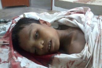 almol Killed Kid