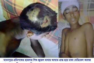 মাধবপুরে প্রতিপক্ষের দায়ের কোপে ৪র্থ শ্রেনীর ছাত্র শিশু জুয়েল জীবন-মৃত্যুর সন্ধিক্ষনে - Surma Times Archive