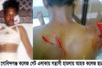 গোবিন্দগঞ্জে কলেজ ছাত্রকে কুপিয়েছে সন্ত্রাসীরা: প্রতিবাদে সড়ক অবরোধ - Surma Times Archive