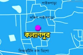 গরম পানি ঢেলে স্বামীকে ঝলসে দিলেন স্ত্রী! - Surma Times Archive