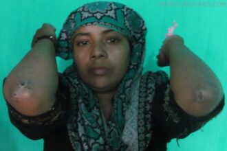 গৃহবধূকে নির্মম নির্যাতন, সন্তানকেও হত্যা: তারপরও মামলা নেয়নি থানা! - Surma Times Archive
