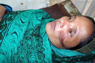 যৌতুক না পেয়ে গৃহবধূর মুখে খুন্তির ছ্যাঁকা - Surma Times Archive