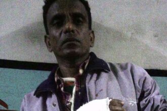 চুনারুঘাটে ছিনতাইকারীর দায়ের কুপে ফেক্সিলোড ম্যানাজার গুরুত্বর আহত - Surma Times Archive
