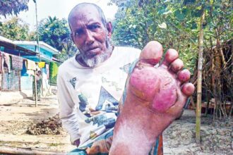 কুলাউড়ার মানসিক ভার‌সাম্যহীনকে বিএসএফ'র বর্বর নির্যাতন - Surma Times Archive
