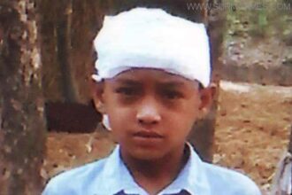 কানাইঘাটে প্রধান শিক্ষকের নির্মম নির্যাতনের শিকার তৃতীয় শ্রেণীর ছাত্র - Surma Times Archive