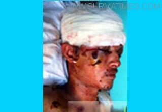 এমসি কলেজে সংঘর্ষ : আহত ছাত্রলীগ কর্মী শাহিনকে ঢাকায় প্রেরণ - Surma Times Archive